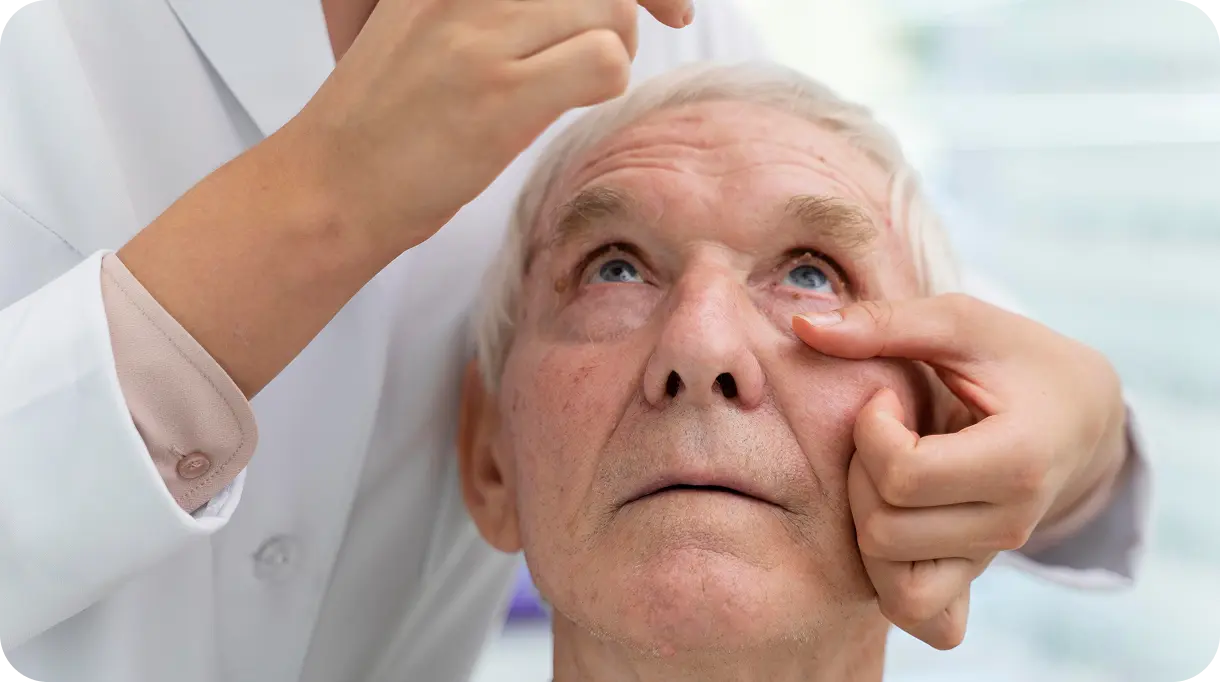 cataracts-second-image